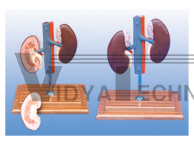 The dissection model of pig kidney(2parts)